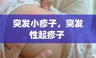突发小疹子,突发性起疹子