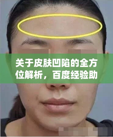 关于皮肤凹陷的全方位解析,百度经验助你了解全部真相!